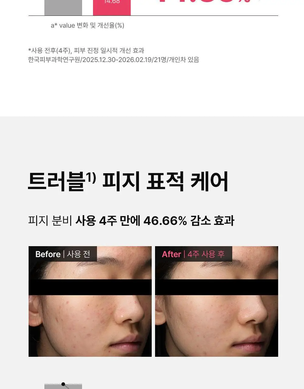 [트러블표적케어] 동아제약 아크네 프로 크림제 30ml 상세페이지 12